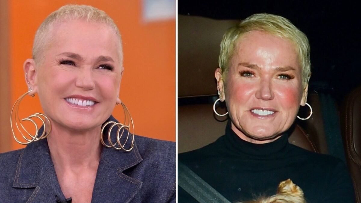 Xuxa exibe fios mais volumosos após transplante capilar feito há seis meses - Imagem do artigo