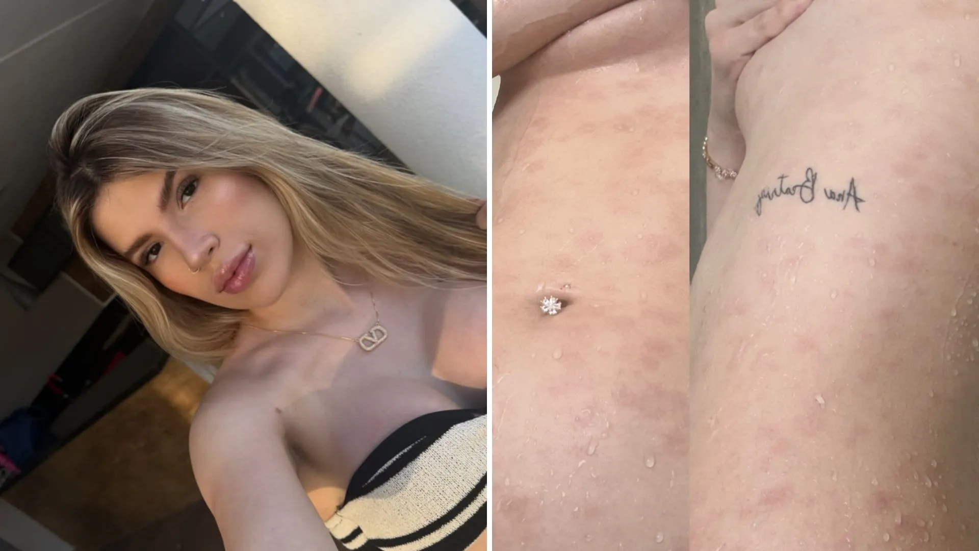 Isabelli Mafra contrai sífilis durante namoro, diz ela - Imagem do artigo