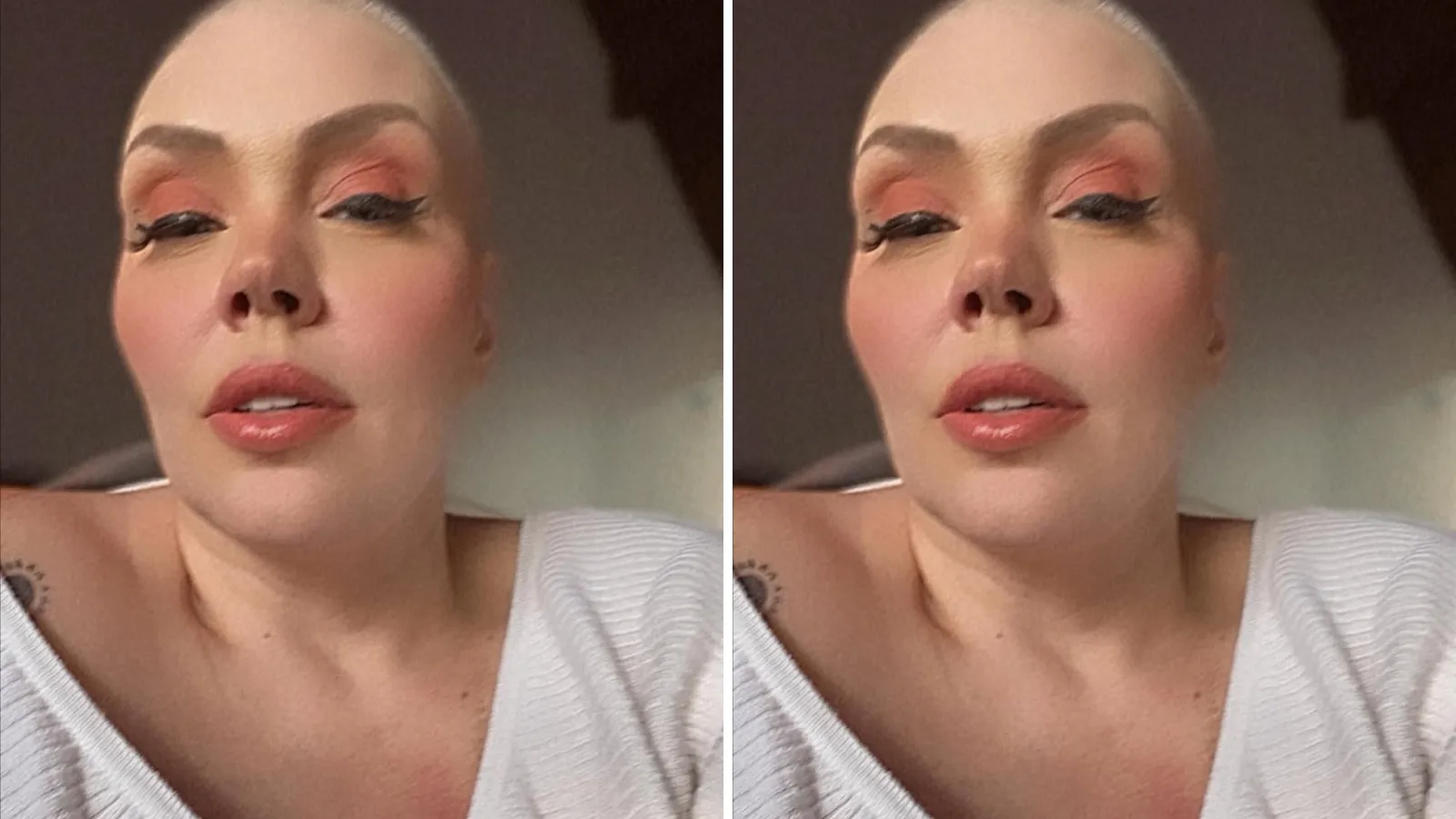 Simony câncer de mama: foto careca marca Dia Mundial - Imagem do artigo