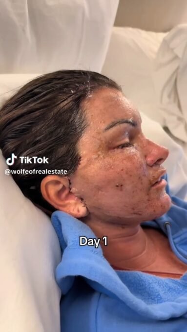 Lifting facial: corretora gasta R$ 416 mil após separação - Imagem do artigo original