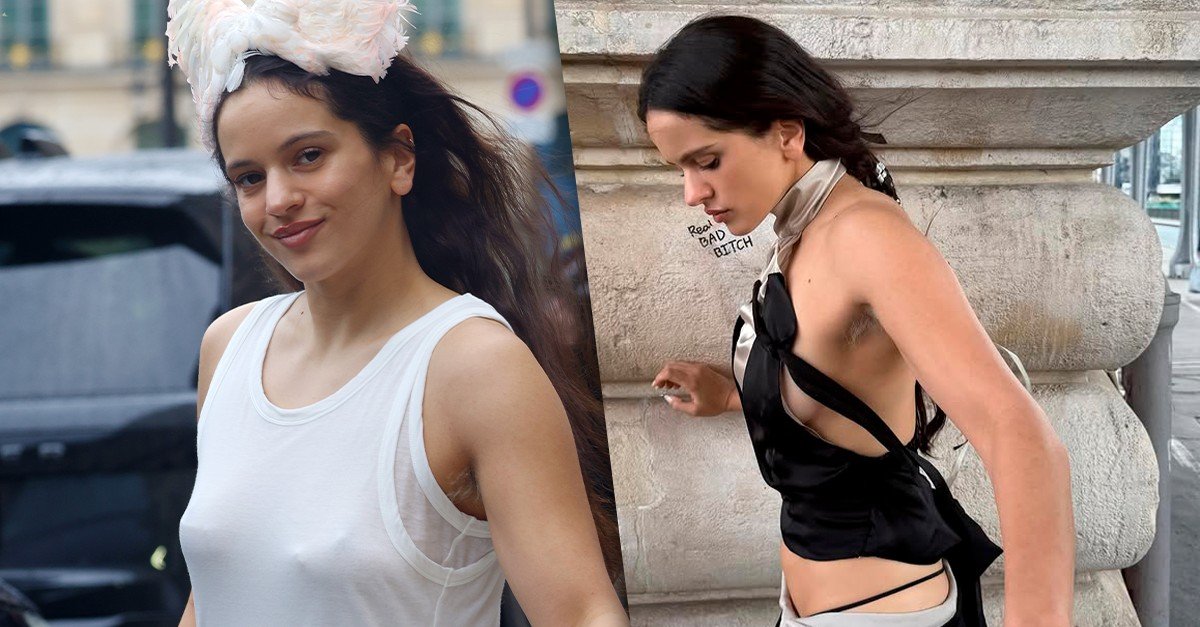 Descolorir pelos da axila: riscos e cuidados essenciais - Imagem do artigo