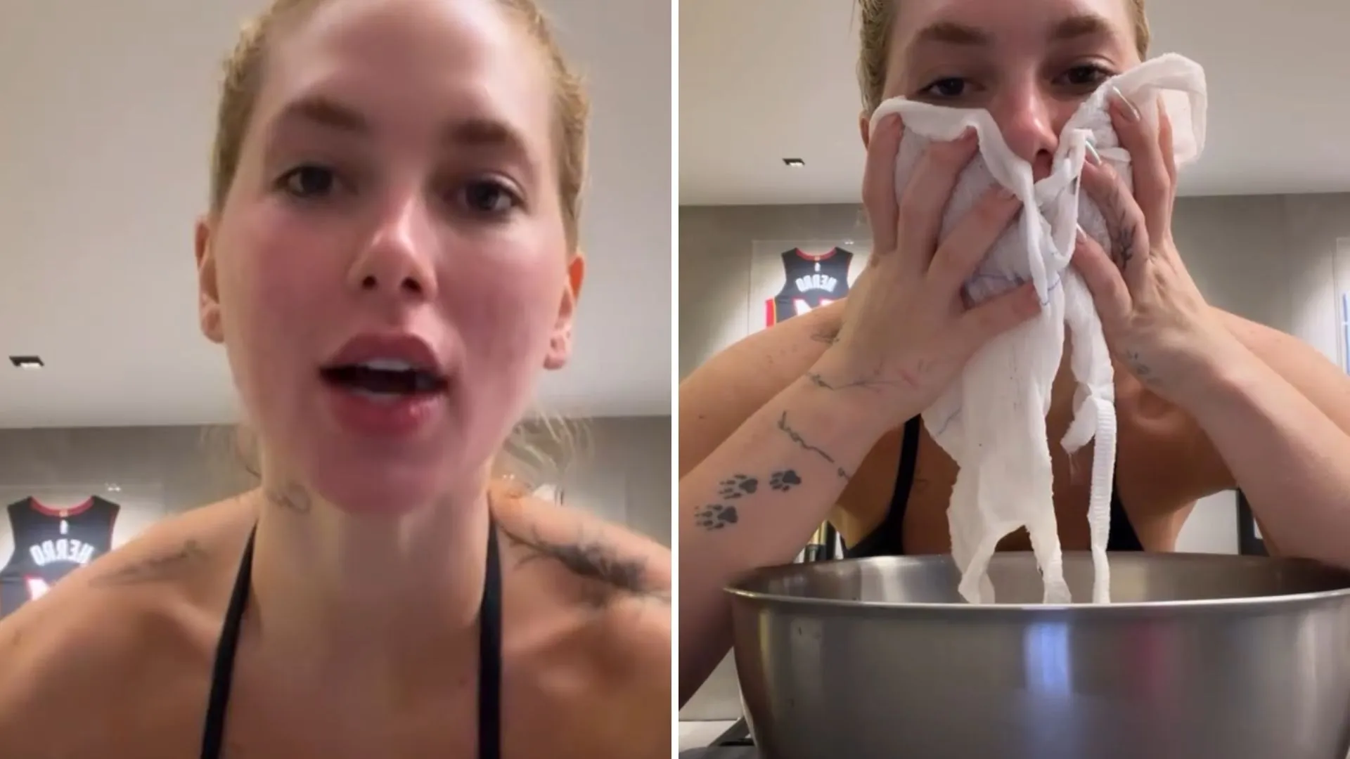 Compressa de vinagre acelera recuperação de Virginia Fonseca - Imagem do artigo