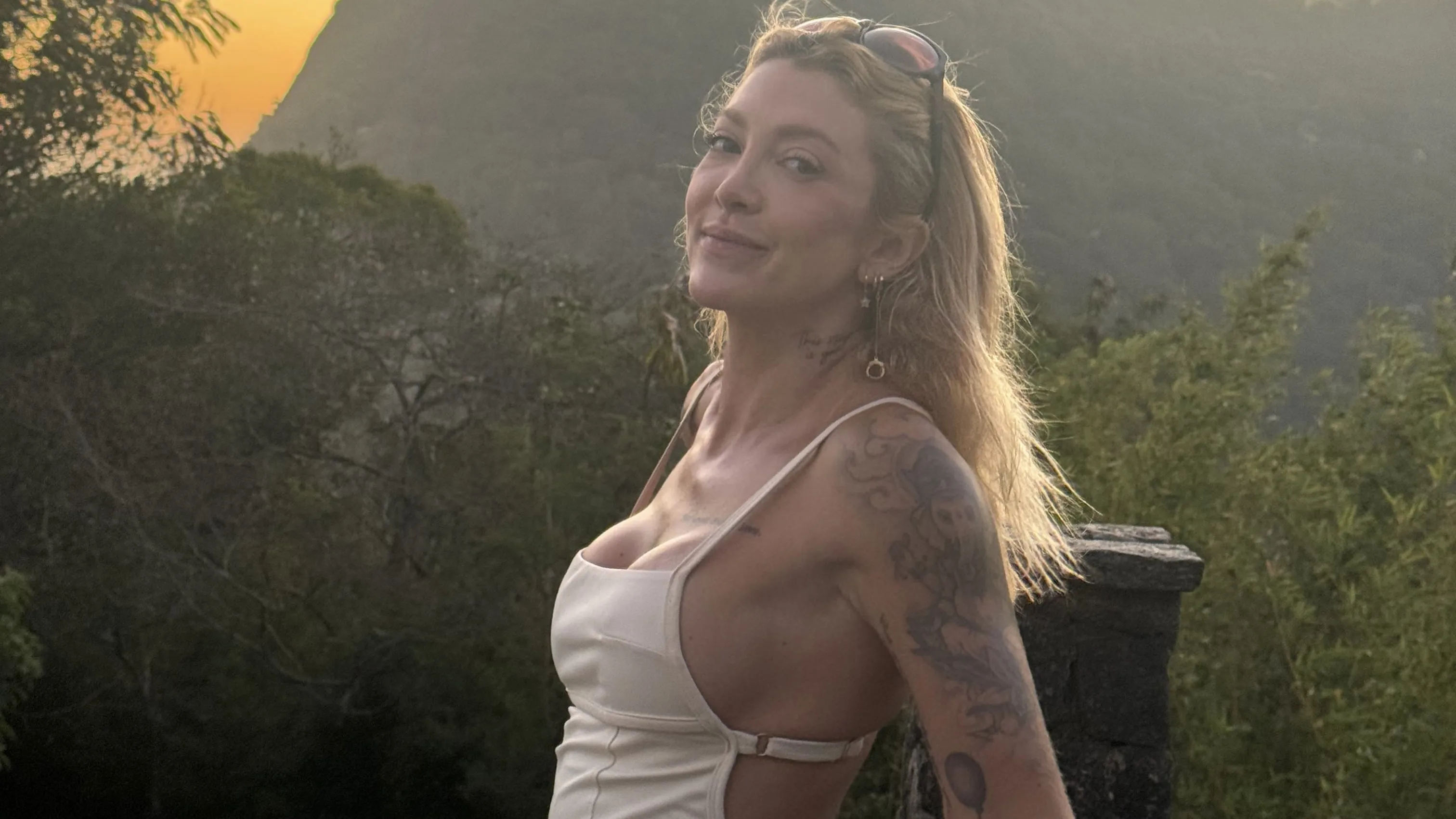 Mastectomia preventiva: brasileira remove mamas aos 32 - Imagem do artigo