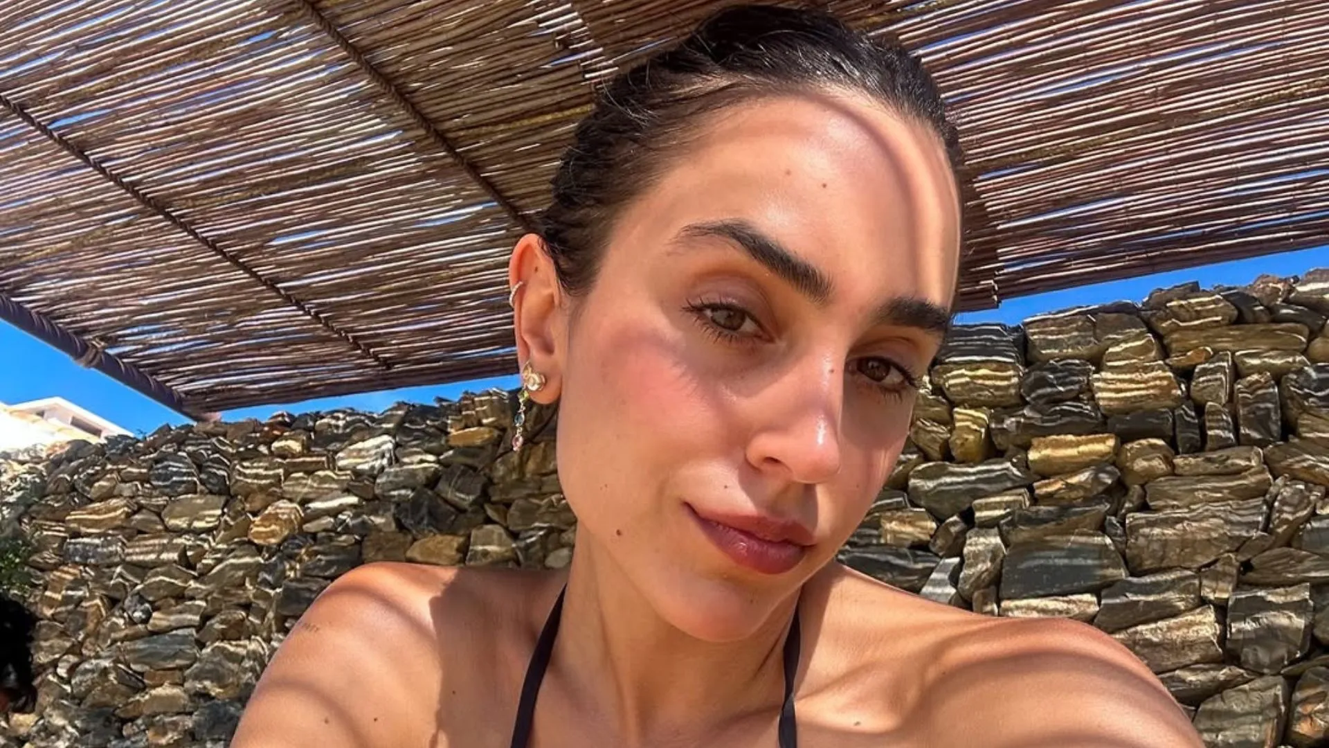 Tratamentos de beleza a evitar no verão, diz dermatologista - Imagem do artigo