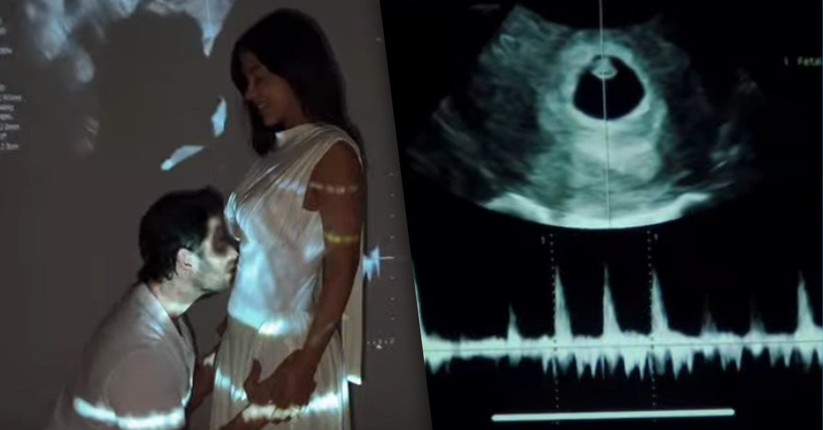 Caneta emagrecedora reduz eficácia do anticoncepcional - Imagem do artigo