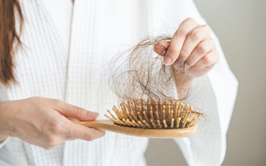 Queda de cabelo: colina, biotina e ferro são essenciais - Imagem do artigo