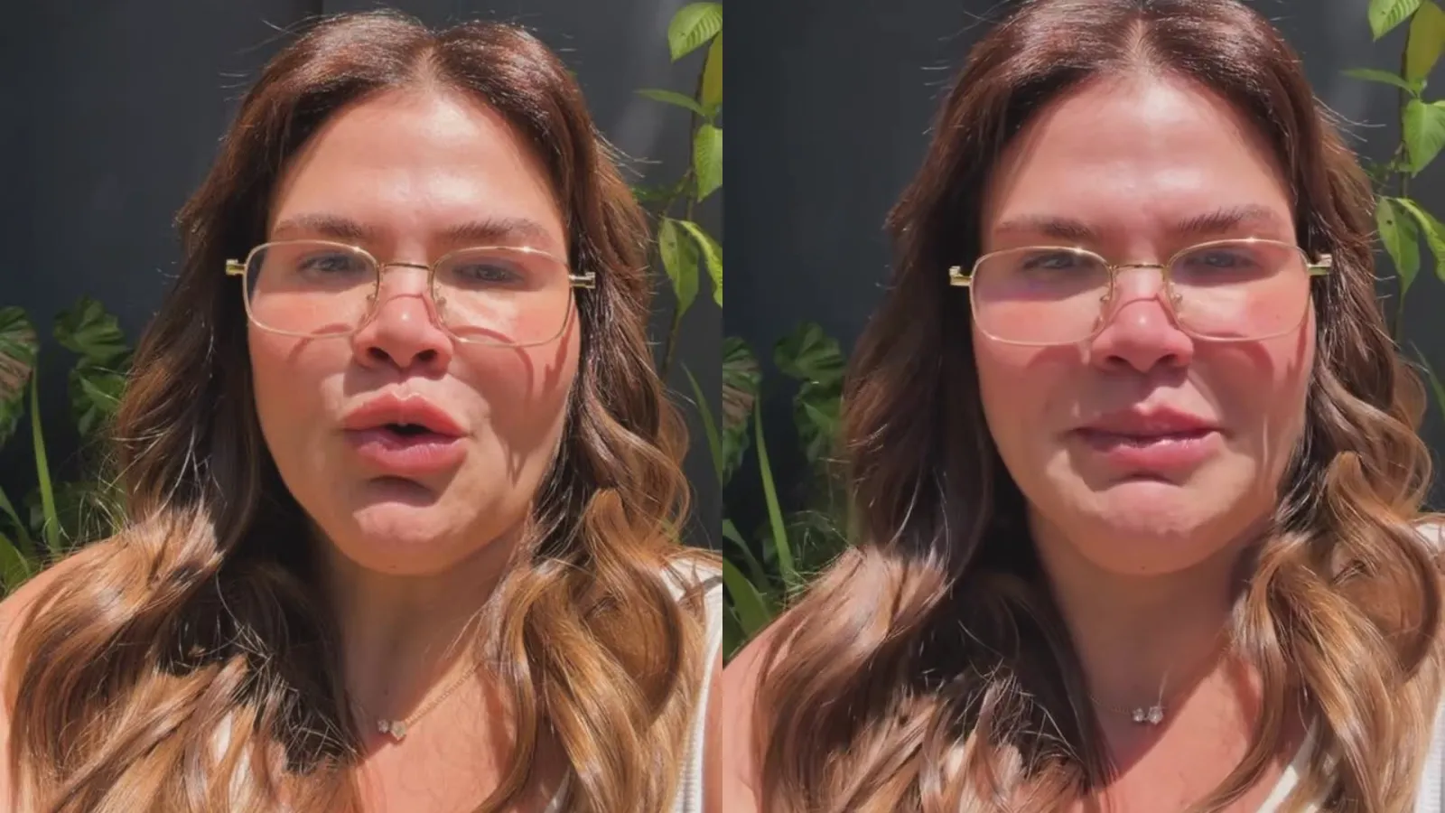 Thais Carla anuncia cirurgia de pele após bariátrica - Imagem do artigo