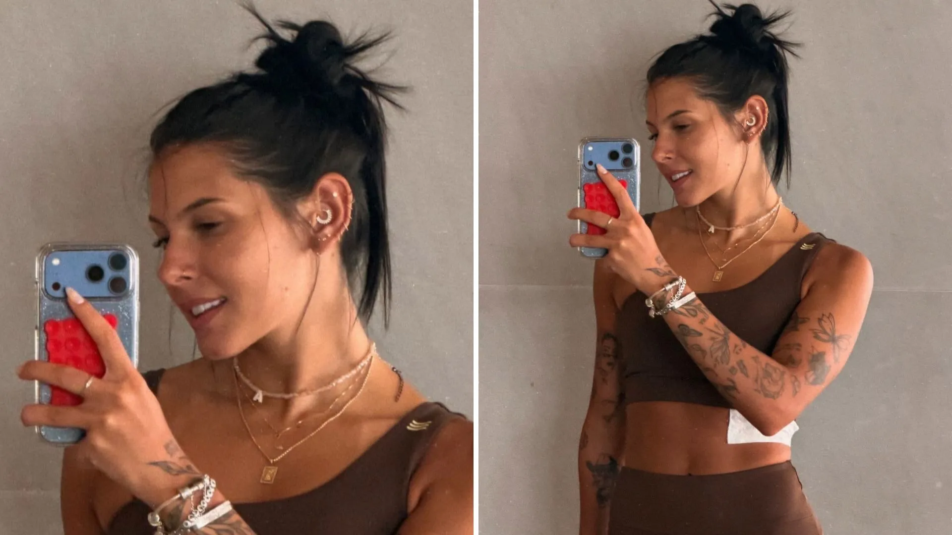 Ana Castela detalha fratura na costela e recuperação - Imagem do artigo