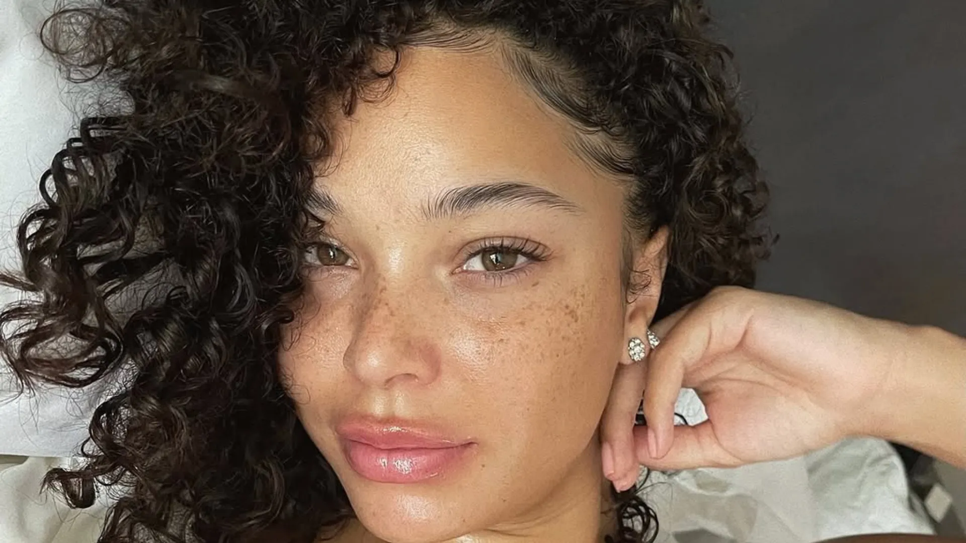 Cuidados com a pele pós-Carnaval: guia dermatológico - Imagem do artigo