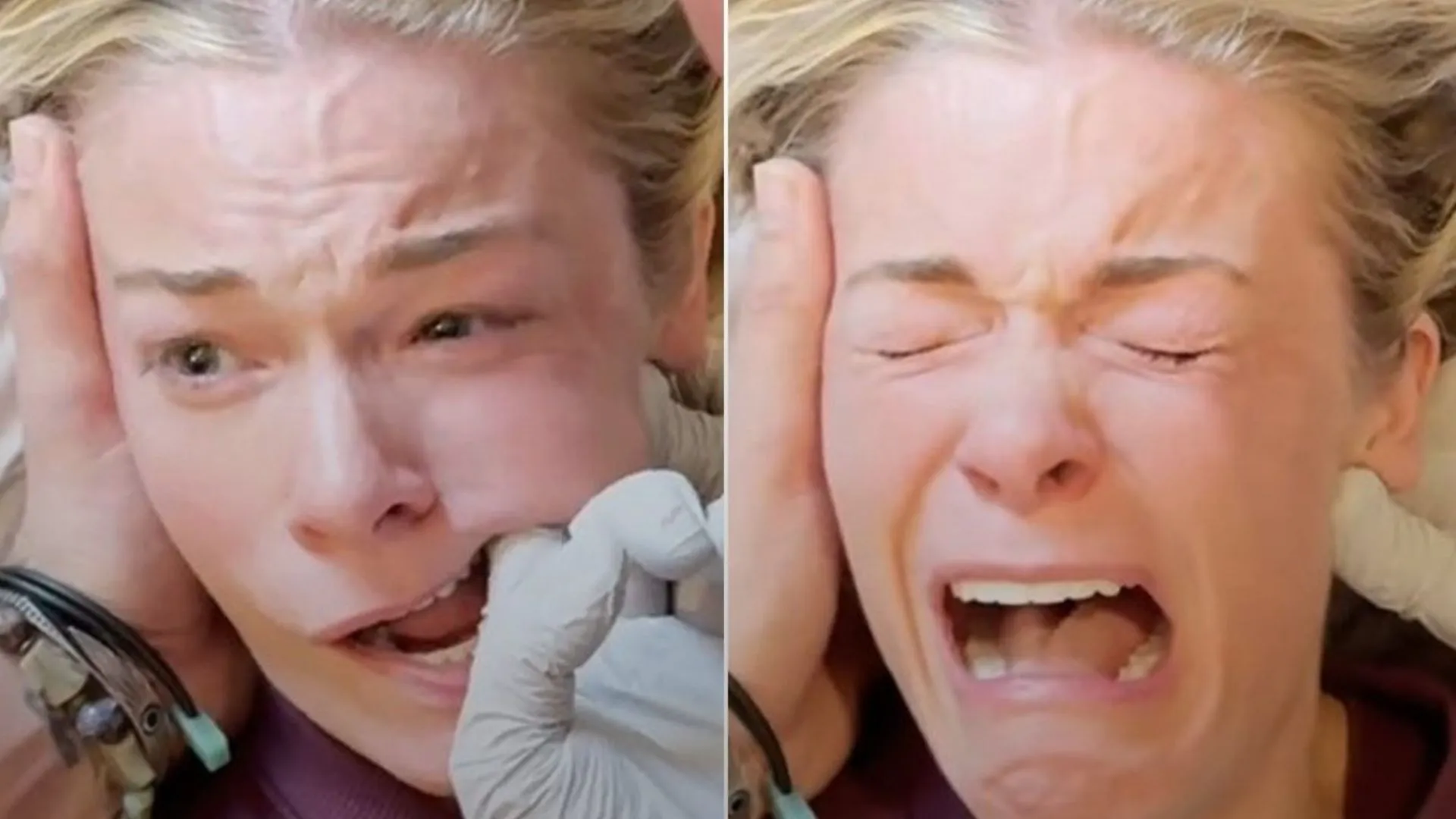 LeAnn Rimes mostra procedimento para aliviar mandíbula - Imagem do artigo