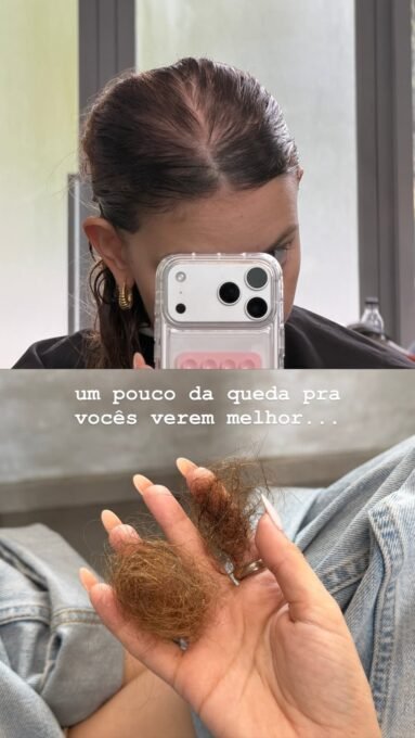 Bruna Furlan corta cabelo após queda na quimioterapia - Imagem do artigo original