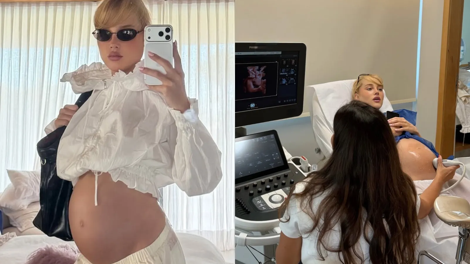 Malu Borges mostra rosto da filha em ultrassom 3D inédito - Imagem do artigo