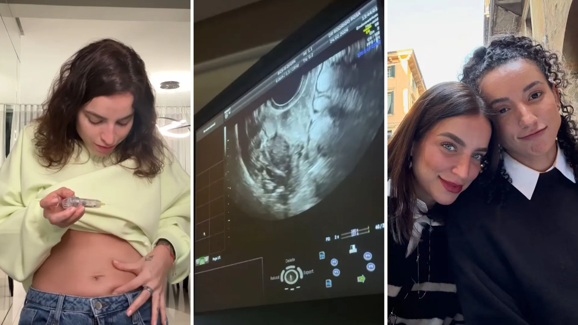 Boo Unzueta congela óvulos e planeja família com Gabi - Imagem do artigo