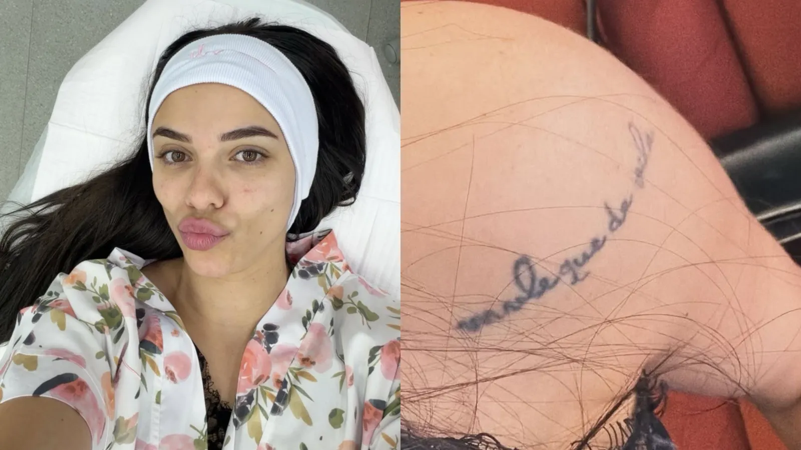 Key Alves remove tatuagem dos 18 anos com laser dolorido - Imagem do artigo