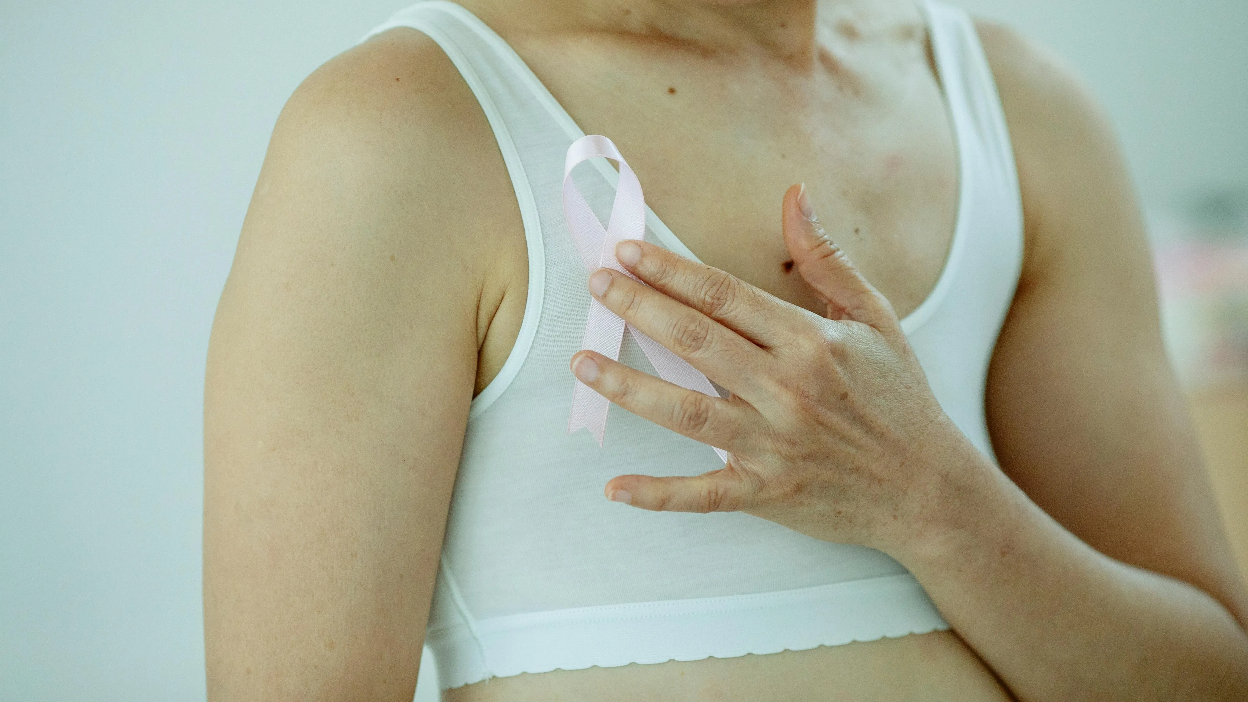 Sexualidade após câncer: impacto e apoio às pacientes - Imagem do artigo