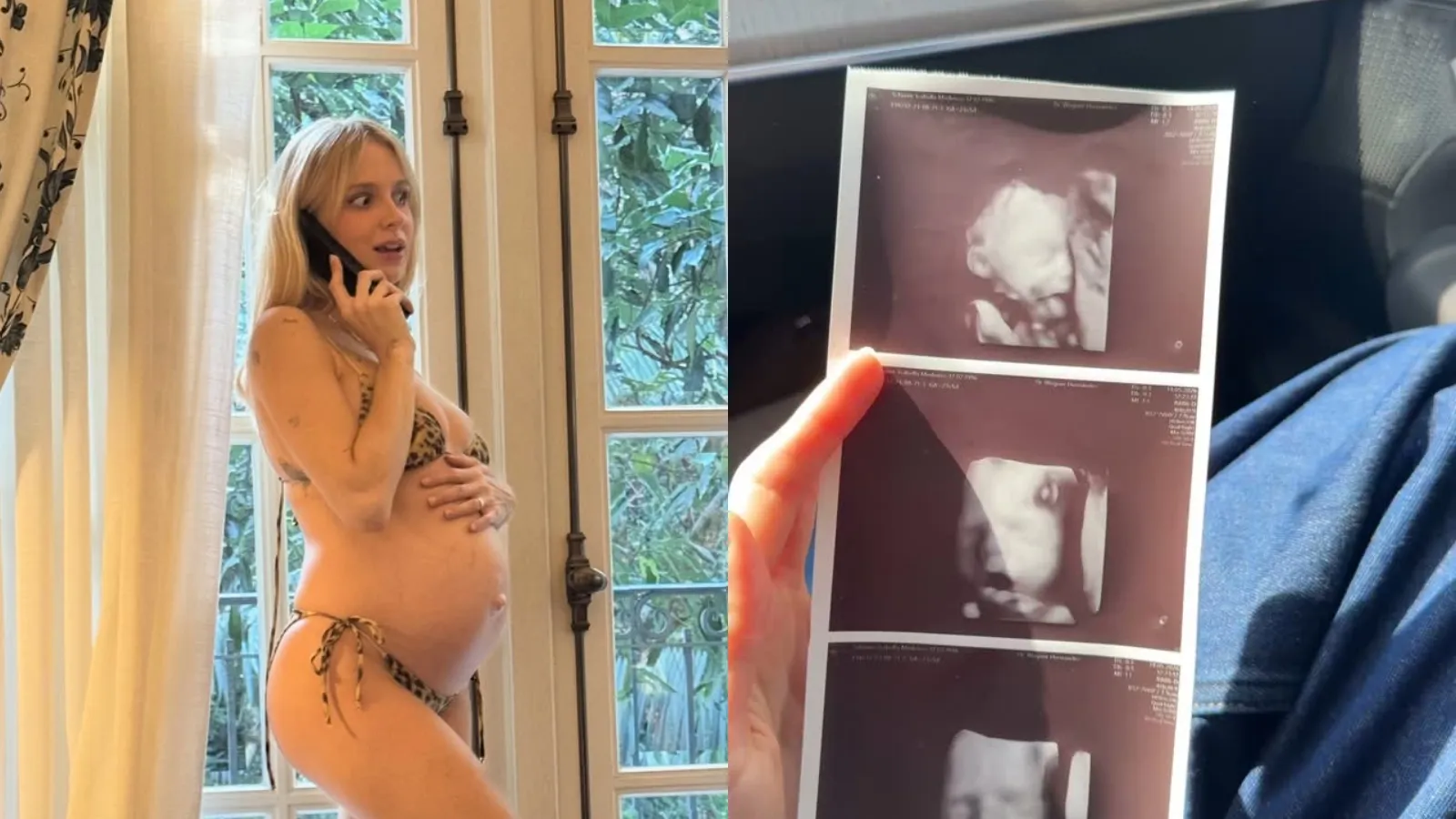 Isa Scherer grávida exibe ultrassom do terceiro filho Tom - Imagem do artigo