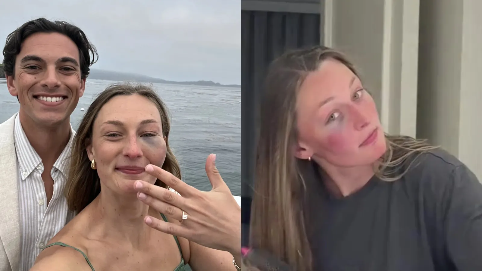 Pedido de casamento com olho roxo viraliza no TikTok - Imagem do artigo