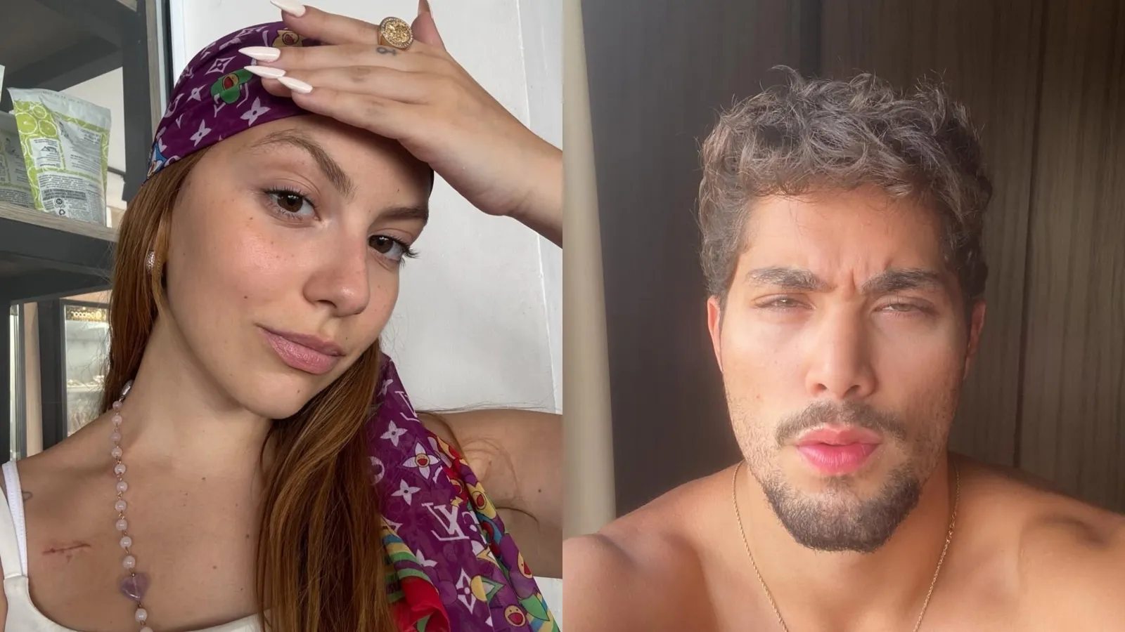Bruna Furlan expõe traição do ex durante luta contra câncer - Imagem do artigo
